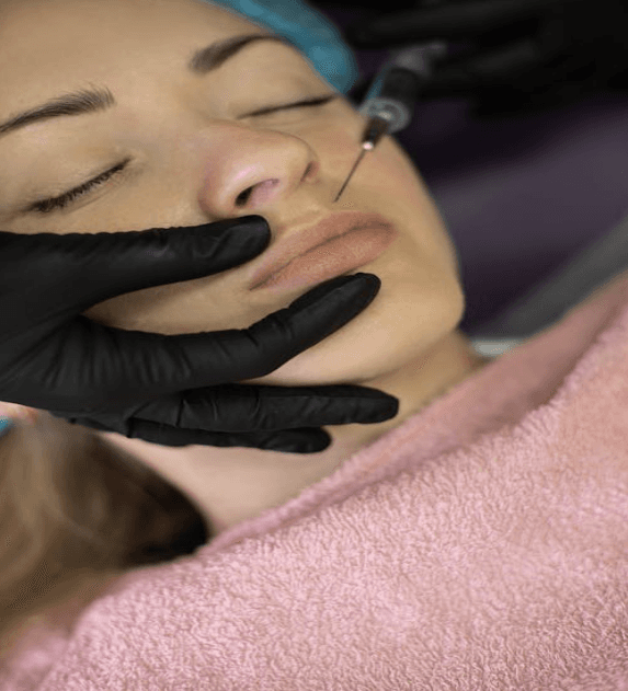 How Long Do Lip Fillers Last?